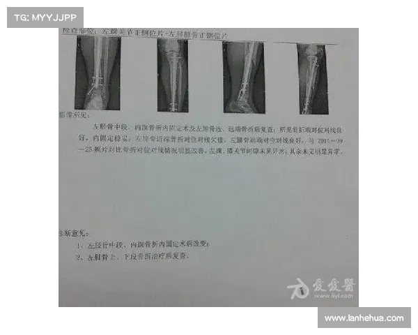 穆西亚拉疑似腓骨骨折紧急送医 担忧赛季报销情况分析 穆西亚拉疑似腓骨骨折紧急送医 担忧赛季报销情况分析